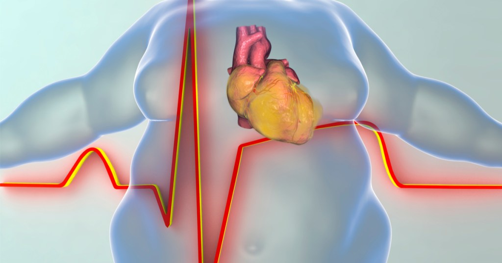 obesity and chronic diseases 1
